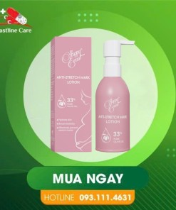 Happy Event Anti-Stretch Mark Lotion - Sữa Dưỡng Ẩm Ngăn Ngừa Rạn Da (Tuýp 125g)Sữa dưỡng ẩm ngừa rạn da Happy Event Anti-Stretch Mark Lotion giúp da săn chắc