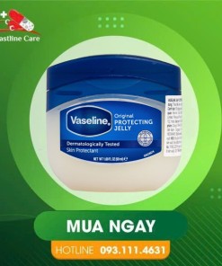 Vaseline Original Protecting Jelly - Sáp Dưỡng Ẩm Dành Cho Da Khô (Hộp 50ml)sap-vaseline-original-protecting-jelly-lam-min-da-50ml